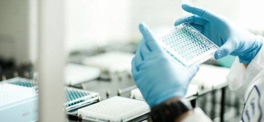 PNAS发现滤泡辅助性T细胞分化调控新机制