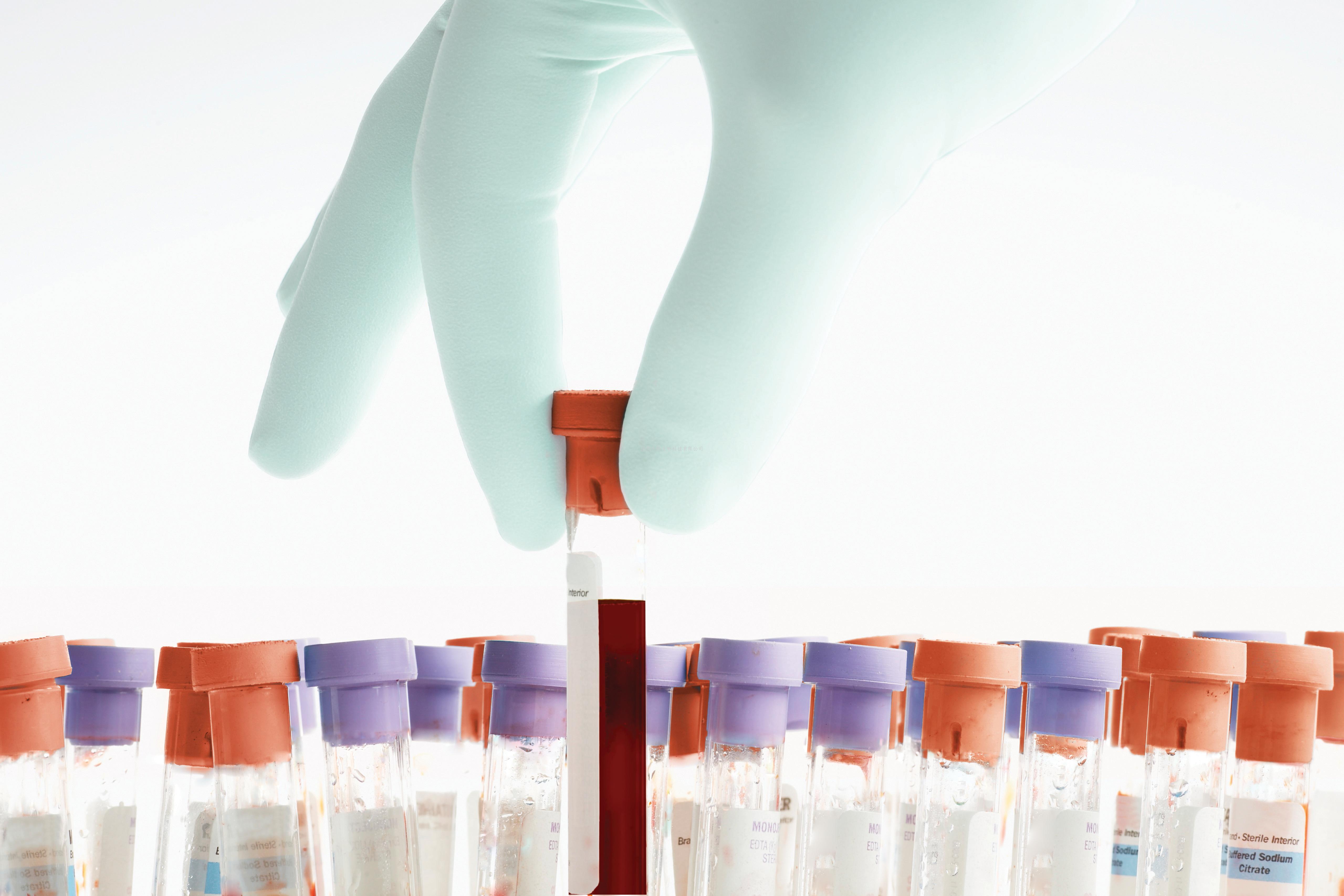 一种新型快速鉴定重要基因功能的遗传学方法