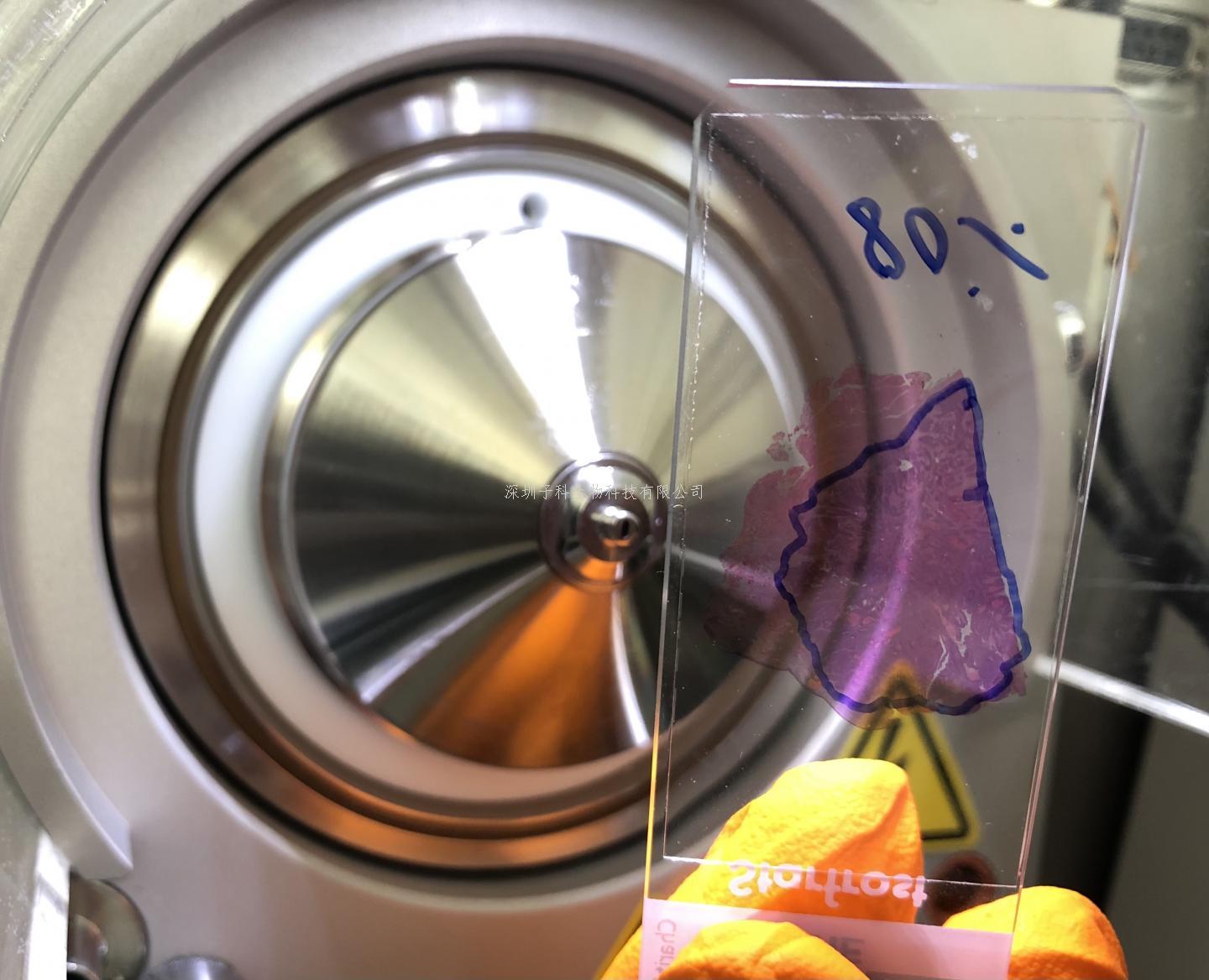 8000多个蛋白质！科学家在蛋白质水平上深入分析癌细胞的分子过程