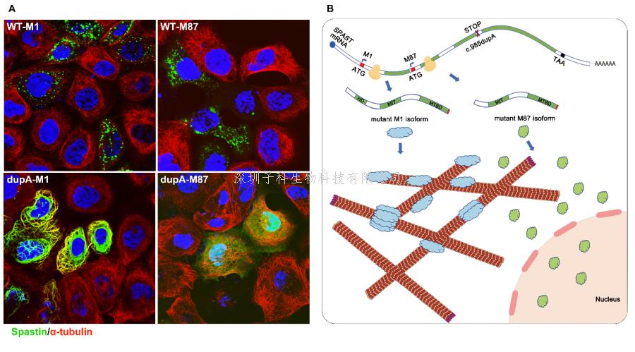 中科院脑智卓越中心发表关于遗传性痉挛性截瘫致病机制的研究成果