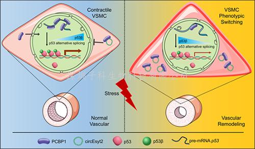 我国学者在环状RNA调控血管重塑保护研究领域取得新进展
