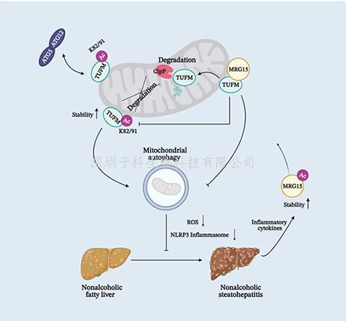营养与健康所丁秋蓉课题组发现治疗非酒精性脂肪肝炎的潜在新靶点
