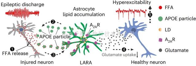 我院闫超/陈迪俊合作揭示脂堆积的星形胶质细胞在癫痫病理中的作用
