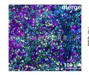 肿瘤医院周光飚教授团队在肿瘤免疫疗法疗效预测上取得新进展