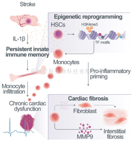 中风损伤大脑 还损伤先天免疫记忆 IL-1β引发慢性合并症/继发性心脏病
