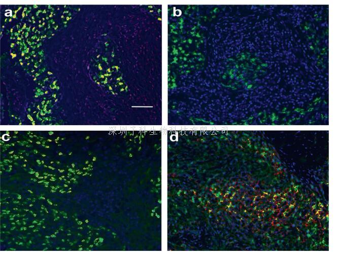 鼻咽癌免疫逃逸新机制：miR-155通过抑制ICOSL和MHC-I表达