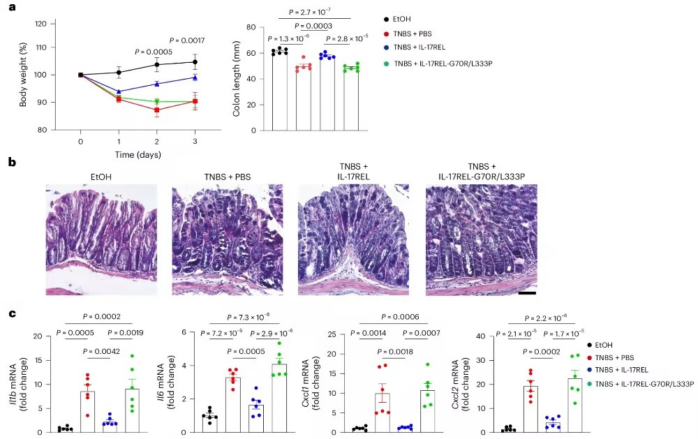Nat Immunol：钱友存/杨涛发现控制肠道炎症的潜在新策略