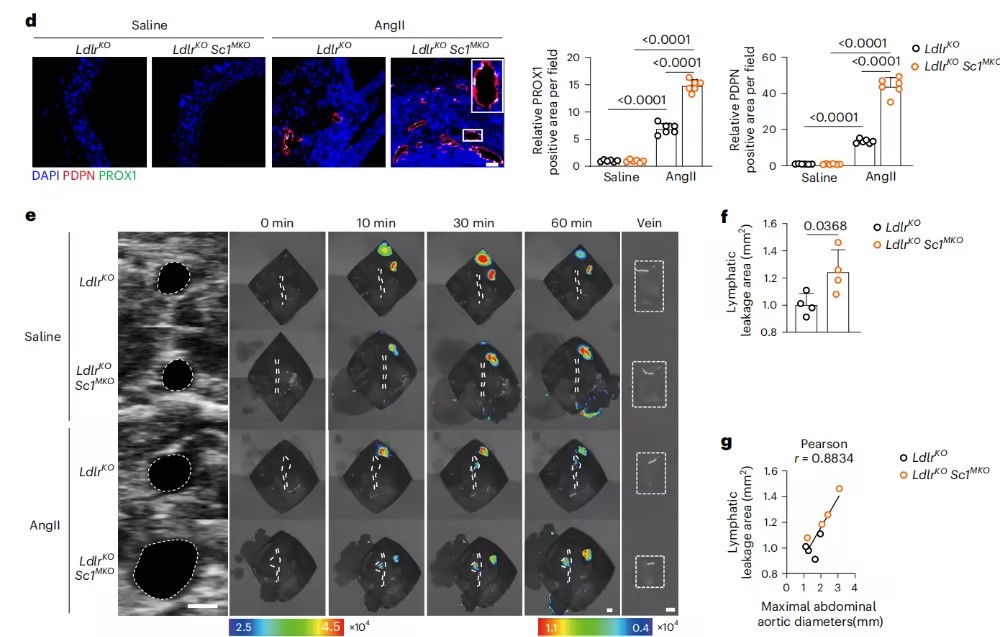Nat Immunol：对抗传统认知！复旦大学阮承超等团队揭示异常淋巴管生成驱动动脉瘤，靶向Sparcl1/FGF2轴成新策略