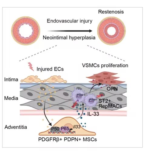 Nat Commun：浙江大学闪波等团队通过局部递送靶向IL33或SPP1的siRNA可有效缓解损伤诱导的血管再狭窄