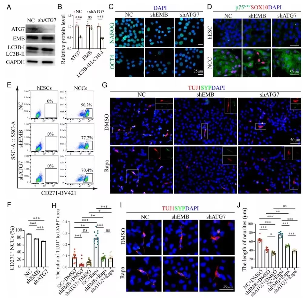 PNAS：华中科技大学冯杰雄团队发现先天性肠神经发育缺陷新机制