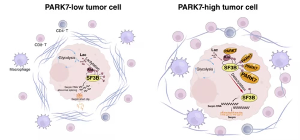 Cancer Res：华中科技大学刘婧/兰培祥发现帕金森病相关蛋白PARK7竟是去乳酸化酶，纠正RNA剪接错误、抗肿瘤纤维化